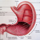 Illustration for article titled Little Known Ways to gastric disease treatmentem/em